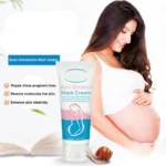 Stretch Mark Cream