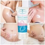 Stretch Mark Cream - Image 2